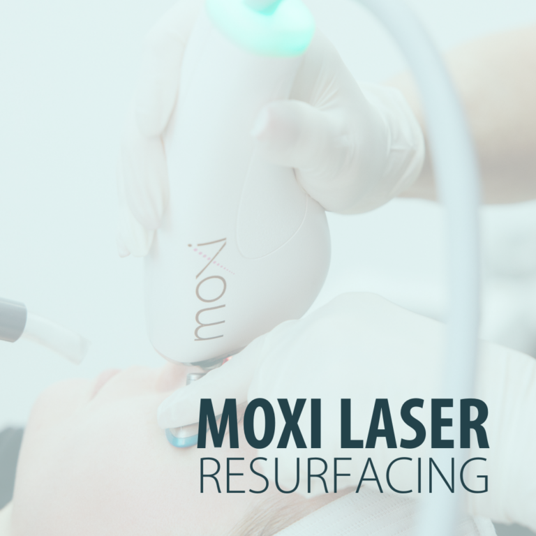 MOXI Laser at Radiance Medspa Louisville