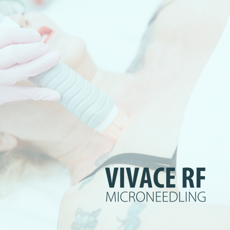 Vivace RF Microneedling at Radiance Medspa Louisville