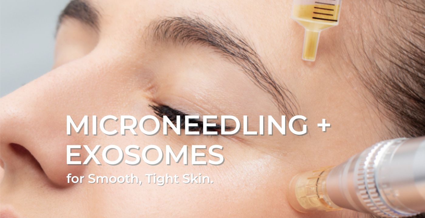 Microneedling month